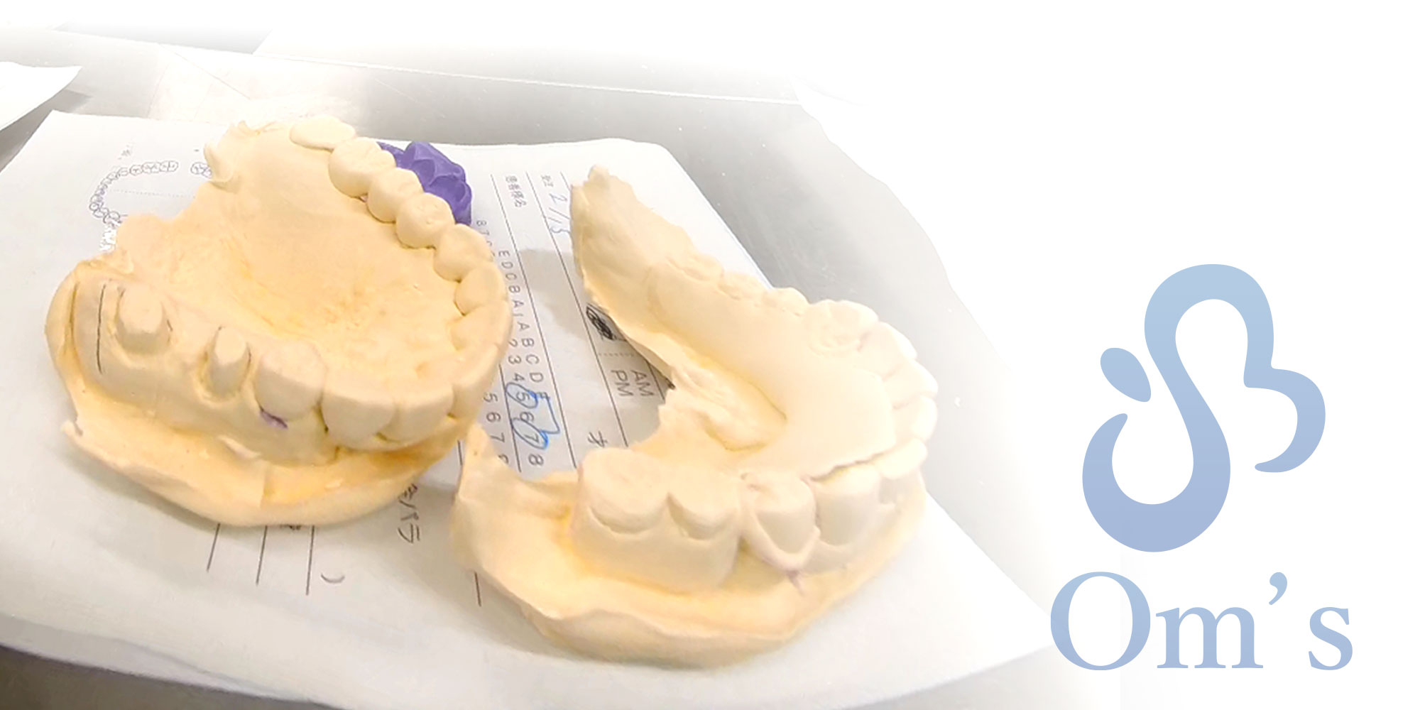 京都府京都市の歯科技工所の歯科技工所 株式会社オムズOm’s Corporationの取り扱い技工物