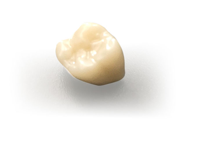 京都府京都市の歯科技工所の歯科技工所オムズコーポレーションOm’s Corporation