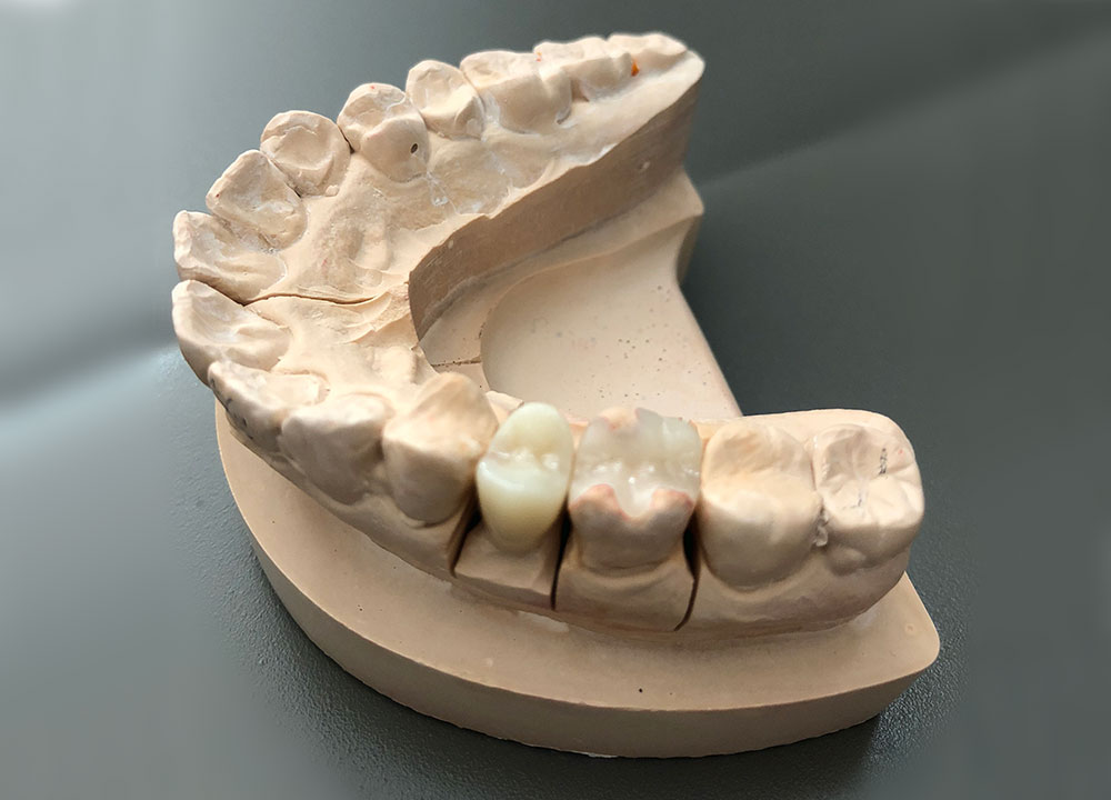 京都府京都市の歯科技工所の歯科技工所オムズコーポレーションOm’s Corporation