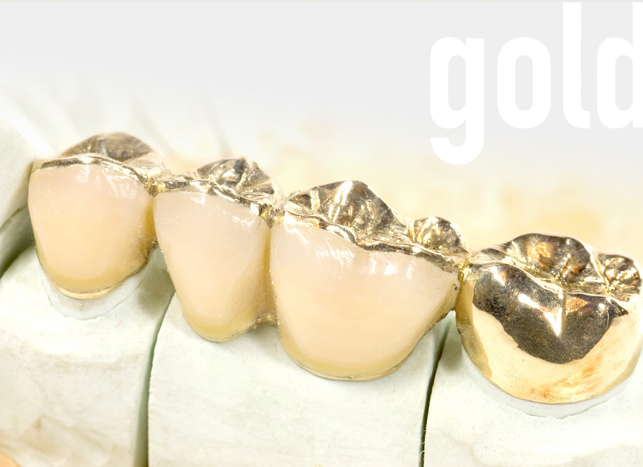京都府京都市の歯科技工所オムズコーポレーションOm’s Corporationのゴールド