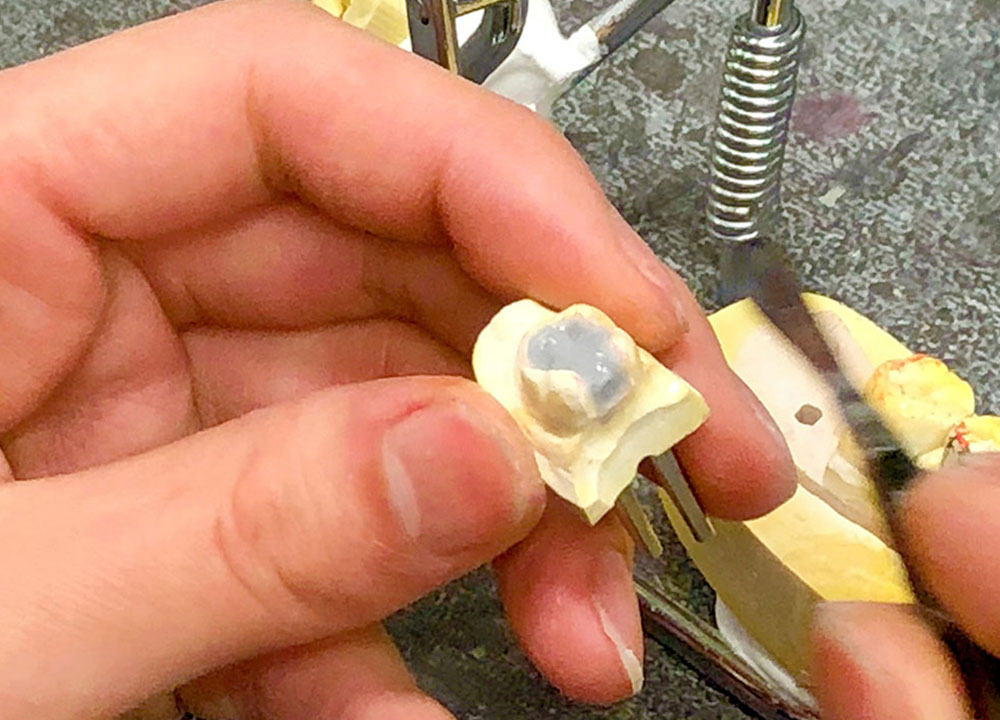 京都府京都市の歯科技工所の歯科技工所オムズコーポレーションOm’s Corporation